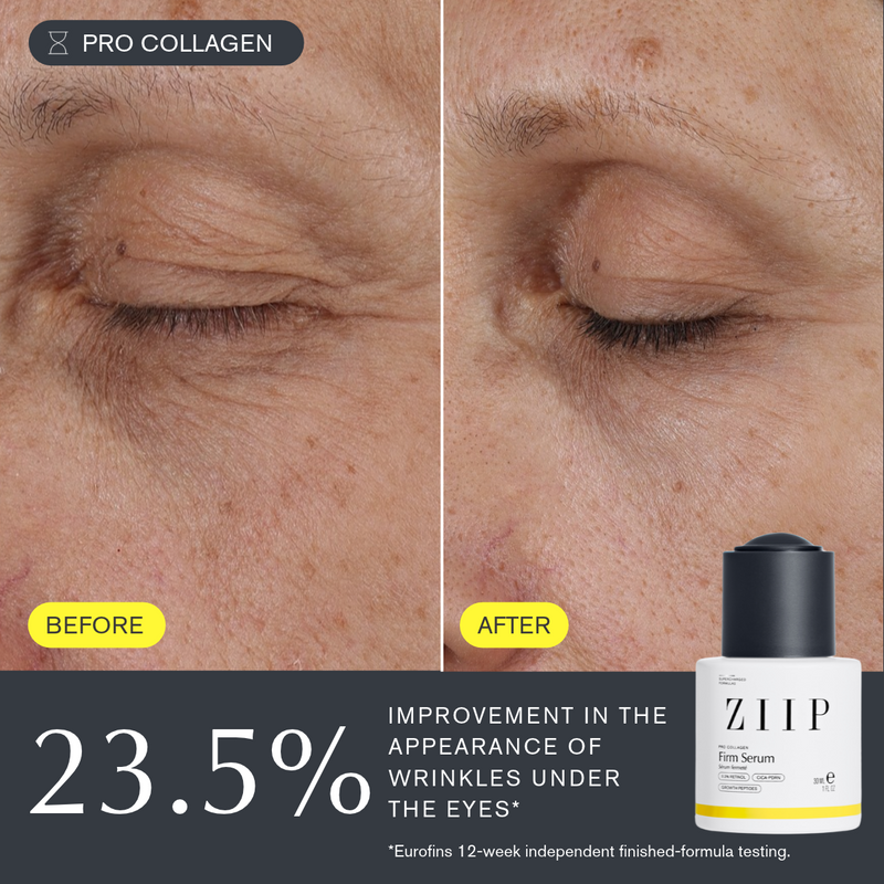 ZIIP Firm Retinol Serum