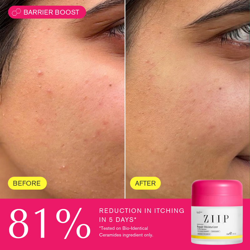 ZIIP Repair Ceramide Moisturiser
